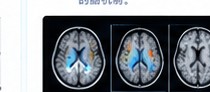 fMRI 脑功能成像